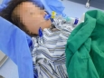 罕见！3岁女童突发脑梗死，柳州市工人医院首次为幼儿成功实施急诊血管内治疗-机械取栓术