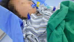 罕见！3岁女童突发脑梗死，柳州市工人医院首次为幼儿成功实施急诊血管内治疗-机械取栓术