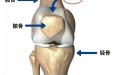 工医科普 | 年轻人不可忽略的膝关节损伤——髌骨脱位
